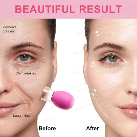 Facial Cupping Therapy Set