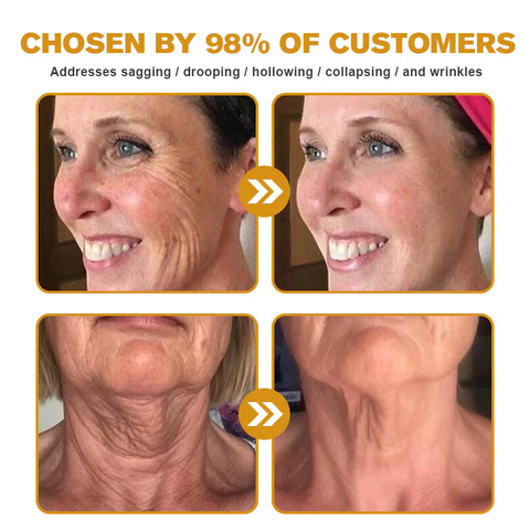 Botox Bee Venom Wrinkle Removal Cream 👨‍⚕️ Made and Shipped from US✅